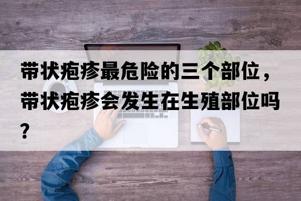 帶狀皰疹最危險的三個(gè)部位，帶狀皰疹會(huì )發(fā)生在生殖部位嗎？